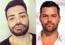 «Gemelo de Ricky Martin»: Se hizo cirugías para ser como el cantante "Gemelo de Ricky Martin": Joven se hace cirugías para igualar al artista