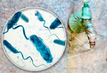 Cólera: Síntomas y causas de su contagio Cólera: Síntomas y causas de su contagio