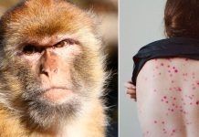 ¡Peligro! Patógeno de viruela de mono ha mutado ¡Peligro! Patógeno de viruela de mono ha mutado