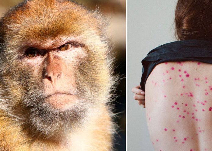 ¡Peligro! Patógeno de viruela de mono ha mutado