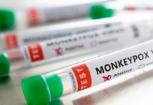 OMS contabiliza más de 3.400 casos de viruela del mono en 50 países 3,400 casos de viruela en lo que va del año según OMS