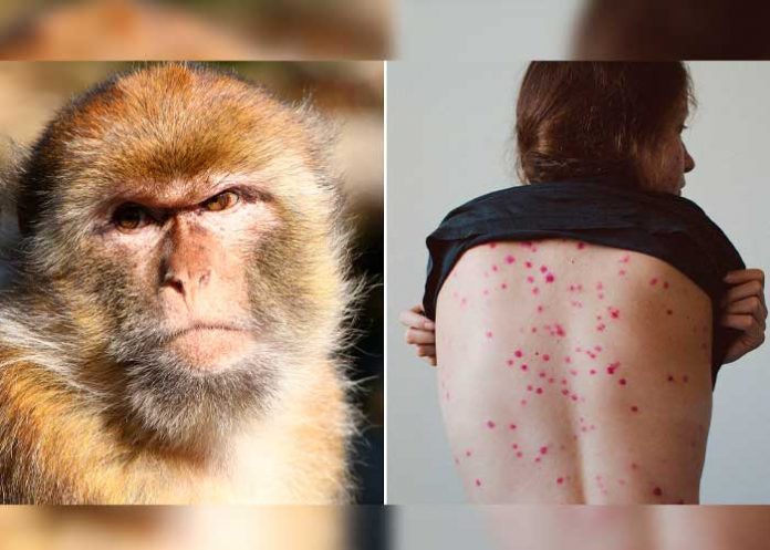 Detectan en EE.UU. dos cepas distintas de viruela del mono