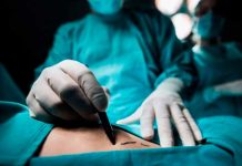 Fallece al realizarse liposucción y el «médico» ofrece pagar el sepelio Fallece al realizarse liposucción y el "médico" ofrece pagar el sepelio