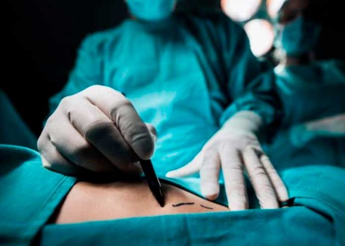 Fallece al realizarse liposucción y el 