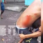 Pleito vecinal en la Isla de Ometepe deja a 2 personas heridas Pleito vecinal en la Isla de Ometepe deja a 2 personas heridas