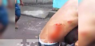 Pleito vecinal en la Isla de Ometepe deja a 2 personas heridas
