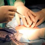 Le cortan la oreja a un bebé durante la cesárea por operar sin luz