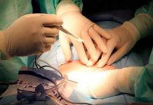 Le cortan la oreja a un bebé durante la cesárea por operar sin luz Le cortan la oreja a un bebé durante la cesárea por operar sin luz