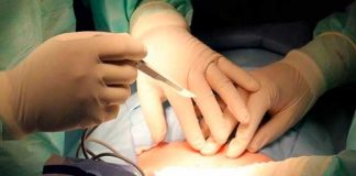 Le cortan la oreja a un bebé durante la cesárea por operar sin luz