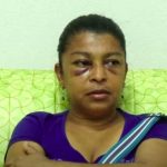 Testimonio de mujer que sufrió agresión de un sacerdote en Nandaime Mujer que sufrió golpes y agresión por parte de un sacerdote en Nandaime