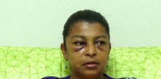 Mujer que sufrió golpes y agresión por parte de un sacerdote en Nandaime