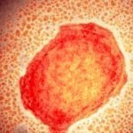 Entérate de otras enfermedades con síntomas similares a la viruela del mono