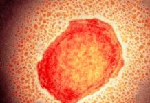 Entérate de otras enfermedades con síntomas similares a la viruela del mono Entérate de otras enfermedades con síntomas similares a la viruela del mono