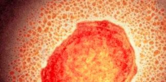 Entérate de otras enfermedades con síntomas similares a la viruela del mono