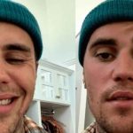 ¡Justin Bieber está de vacaciones luego de la parálisis facial