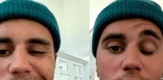 ¡Justin Bieber está de vacaciones luego de la parálisis facial