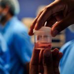 Registran 41 casos de la infección conocida como Hongo Negro en Honduras Registra 41 casos de la infección conocida como Hongo Negro en Honduras.