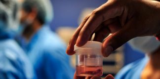 Registra 41 casos de la infección conocida como Hongo Negro en Honduras.