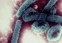 Marburgo: Peligroso virus que presenta 2 muertes en Ghana Marburgo: Peligroso virus que presenta 2 muertes en Ghana