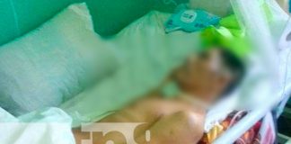 Piden ayuda para "El Chino" hombre que fue atropellado en Rivas