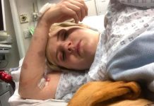 ‘Extraño síndrome’ afecta a joven al reírse, llorar, estar triste o estresada Síndrome afecta las emociones de Natasha Coates