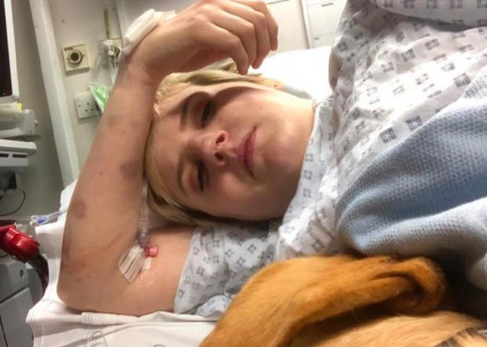 Síndrome afecta las emociones de Natasha Coates