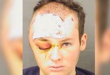Un policía de Florida dispara en la cabeza al secuestrador de su terapeuta Un policía de Florida dispara en la cabeza al secuestrador de su terapeuta