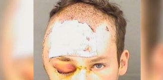Un policía de Florida dispara en la cabeza al secuestrador de su terapeuta