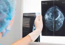 Inteligencia Artificial con alta tasa de éxito para detectar el cáncer de mama Inteligencia Artificial con alta tasa de éxito para detectar el cáncer de mama