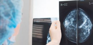 Inteligencia Artificial con alta tasa de éxito para detectar el cáncer de mama