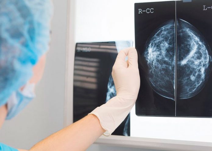 .5 Inteligencia Artificial con alta tasa de éxito para detectar el cáncer de mama