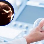 Descubren una forma aterradora en el vientre de una mujer