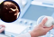 Viral: Una forma aterradora revela la ecografía de una embarazada Descubren una forma aterradora en el vientre de una mujer