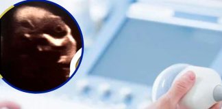 Descubren una forma aterradora en el vientre de una mujer
