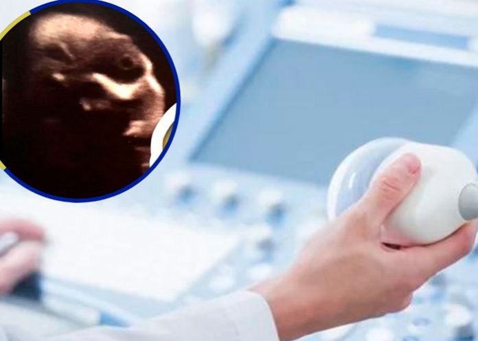 Descubren una forma aterradora en el vientre de una mujer