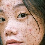 La ciencia demuestra que nadie nace con pecas La ciencia demuestra que nadie nace con pecas