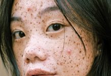 La ciencia demuestra que nadie nace con pecas La ciencia demuestra que nadie nace con pecas