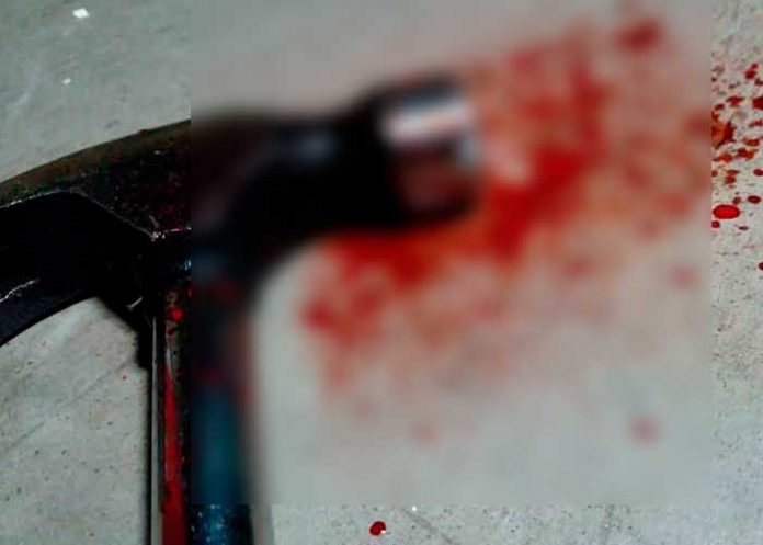 Demoníaca hija mata a martillazos a su anciana madre en Nueva York