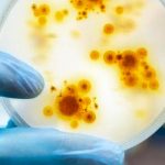 Ministerio de Salud confirma primer caso de viruela del mono en Uruguay Uruguay recordó a población consultar prestador de salud