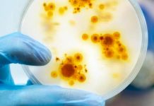 Ministerio de Salud confirma primer caso de viruela del mono en Uruguay Uruguay recordó a población consultar prestador de salud