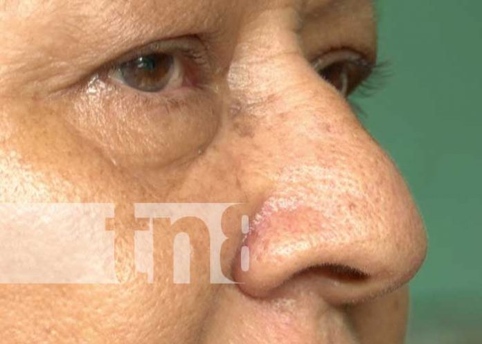 mujer-amputada-2 Mujer perdió su pierna tras múltiple accidente en Carretera Vieja a León