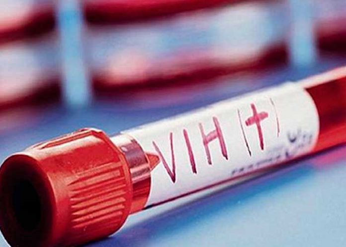 ¡Una luz al final del túnel! Revelan una nueva vulnerabilidad del VIH