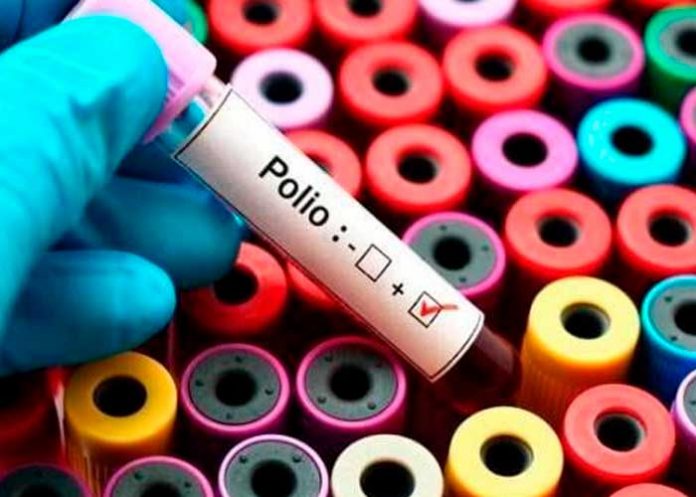 ¡Alerta! En Nueva York detecta el primer caso de poliomielitis en 30 años