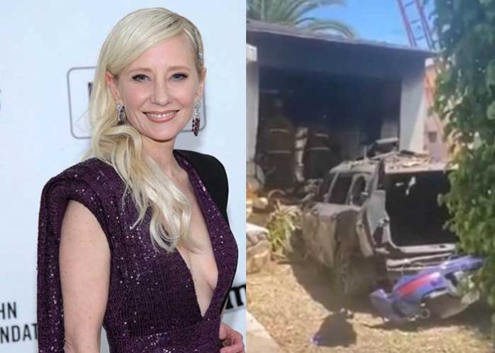 Exceso de drogas: Anne Heche declarada con muerte cerebral