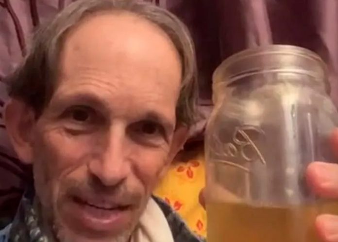 1 Lleva 20 años bebiendo su orina pero sus vecinos se quejan por el olor