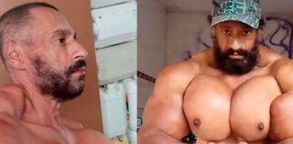 Fallece el "Hulk Brasileño" famoso por aumentar sus músculos con aceite