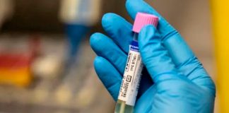 ¡Le llovió! Detectan en Italia COVID y VIH a un mismo paciente