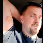 “El rostro de Jesús” aparece en el brazo de un hombre en Reino Unido