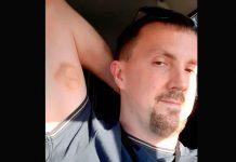 “El rostro de Jesús” aparece en el brazo de un hombre en Reino Unido “El rostro de Jesús” aparece en el brazo de un hombre en Reino Unido