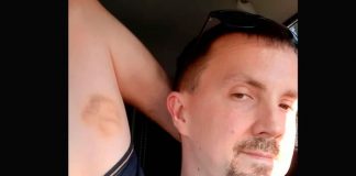 “El rostro de Jesús” aparece en el brazo de un hombre en Reino Unido